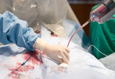 Interventional Cardiology