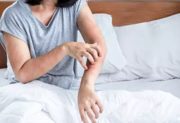 Skin Allergy Management