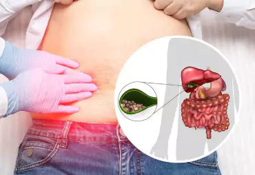 Gallbladder Issues